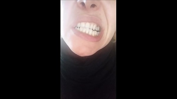 bel viso, ma denti marci!